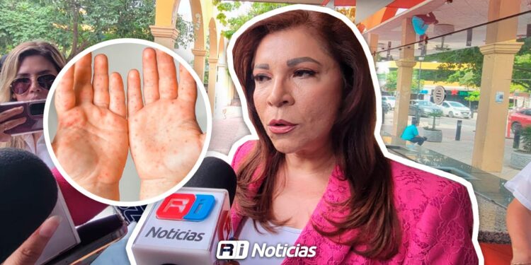 Alerta en primarias de Sinaloa detectan 52 casos de Coxsackie