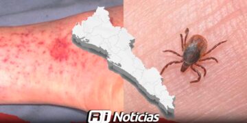 Aumentan a 15 las defunciones por Rickettsia en Sinaloa: preocupación por el descuido de mascotas