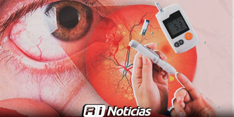 Cerca de 41 mil mazatlecos tienen diabetes; lanzan campaña gratuita contra la Retinopatía Diabética