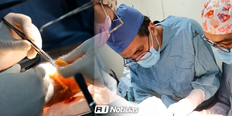 Realiza IMSS Sinaloa 31 trasplantes renales durante 2025