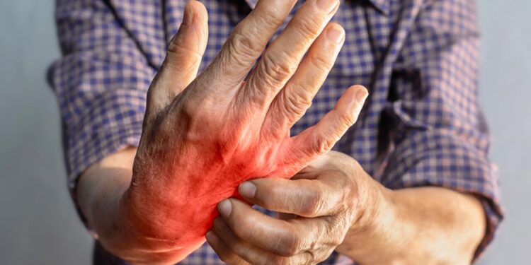 Especialista advierte que osteoartritis afecta al 60 % de mexicanos y empeora con el frío