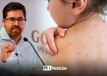 Sinaloa registra 72 casos de sarampión en el año