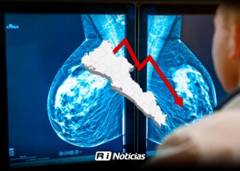 Diagnósticos de cáncer de mama bajaron en 2024, pero la mortalidad repunta en Sinaloa