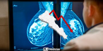 Diagnósticos de cáncer de mama bajaron en 2024, pero la mortalidad repunta en Sinaloa