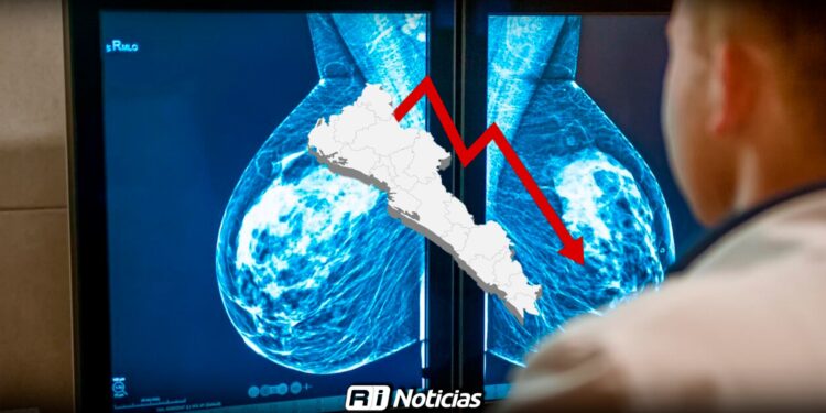 Diagnósticos de cáncer de mama bajaron en 2024, pero la mortalidad repunta en Sinaloa