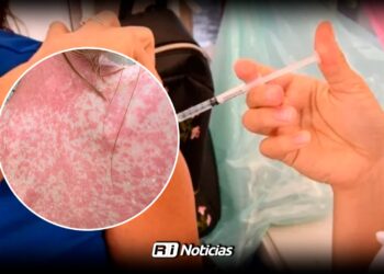 Confirman 33 casos de sarampión en Villa Unión; refuerzan brigadas de vacunación