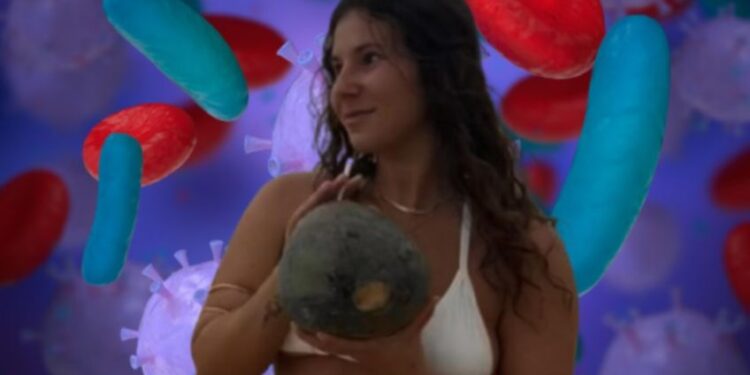 Un parásito se instala en su ojo y le devora la córnea a la tiktoker Vivian Nosovitsky