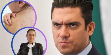 PAN culpa a Morena de muertes por brote de sarampión, acusa falta de vacunación en sexenio de AMLO