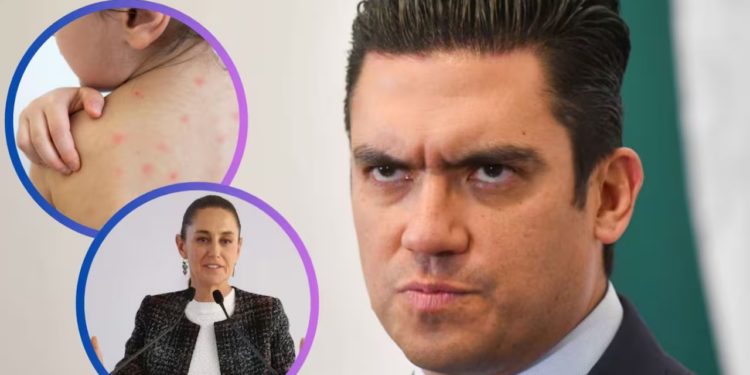 PAN culpa a Morena de muertes por brote de sarampión, acusa falta de vacunación en sexenio de AMLO