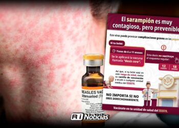 Vacunación sin riesgos: No importa si ya fuiste vacunado contra el sarampión
