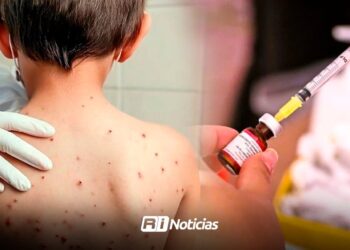 Sinaloa ocupa el sexto lugar nacional en casos de sarampión; reporta 100 contagios en 2026