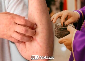 Miércoles de Ceniza será con medidas sanitarias ante riesgo de sarampión