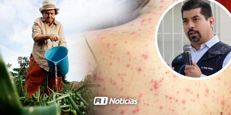 Jornaleros agrícolas ocupan 171 casos de sarampión de los registrados en Sinaloa