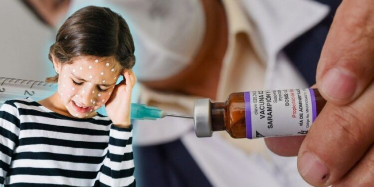 ¿Cuáles son los efectos secundarios de la vacuna del sarampión en niños?