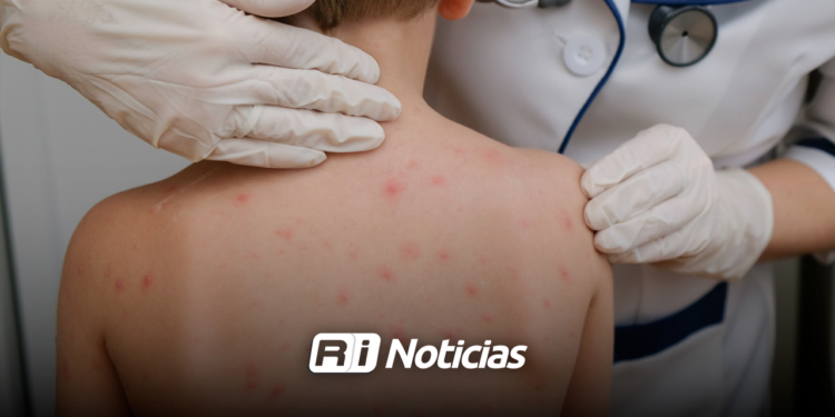 Un contagio por hora: la epidemia de sarampión que México no pudo frenar