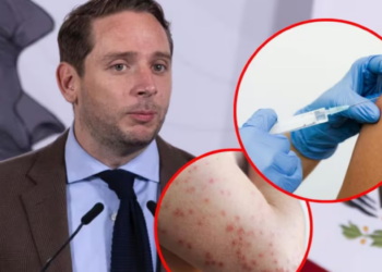 Casos activos de sarampión bajan 30% en México; Salud llama a no bajar la guardia y continuar vacunación