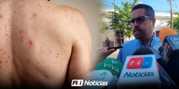 Sinaloa entra al mapa nacional de vigilancia por sarampión; SSA prevé aumento de contagios