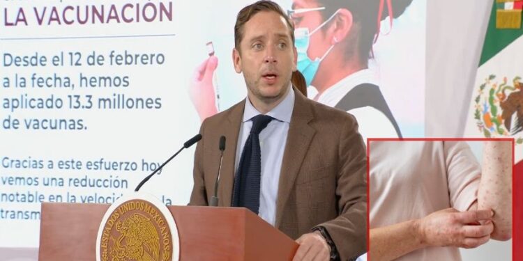 Se han aplicado 13.3 millones de vacunas contra el sarampión en México: Secretaría de Salud