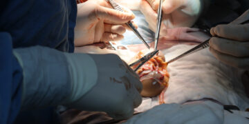 Logra IMSS Sinaloa dos trasplantes renales con apoyo de misión aérea