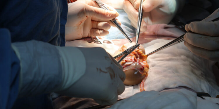 Logra IMSS Sinaloa dos trasplantes renales con apoyo de misión aérea