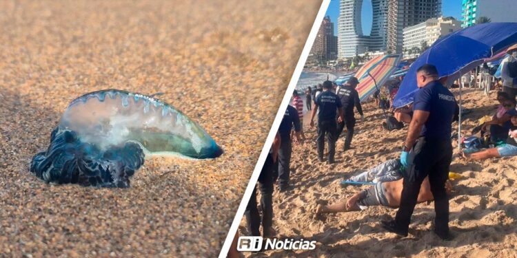 Aumentan atenciones por picaduras de medusa en playas de Mazatlán