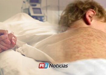 Suman 37 muertes por sarampión en México; Chihuahua concentra la mayoría de los casos