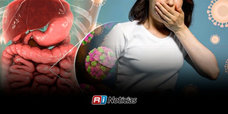 Advierten sobre nuevas cepas del “virus del vómito”: ¿Qué es y Cómo evitar esta enfermedad?