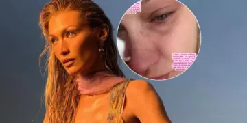 Entre lágrimas, Bella Hadid revela que enfrenta nuevos problemas de salud: “Nada funciona”