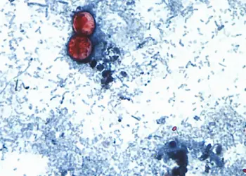 Cyclospora: la crisis alimentaria que enfrenta a México y Estados Unidos