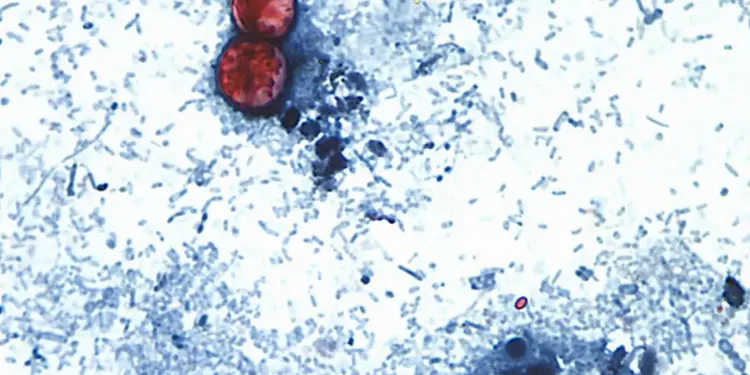 Cyclospora: la crisis alimentaria que enfrenta a México y Estados Unidos