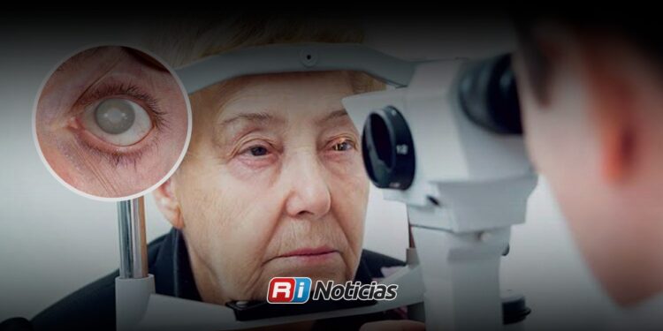 Ofrece Beneficencia Pública cirugías de catarata a 4,500 pesos; en clínicas privadas valen 20,000