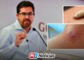 No hay más casos sospechosos de gusano barrenador en humanos: González Galindo