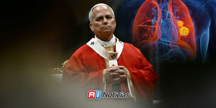 Papa León XIV será operado por un nódulo pulmonar detectado en fase inicial